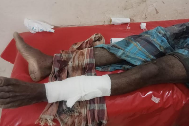 কলাপাড়ায় পারিবারিক বিরোধে চাচার পায়ের রগ কাটল ভাতিজা