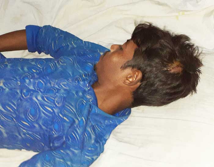 শেরপুরে জমি নিয়ে বিরোধ, মারধর-জখম আহত ১