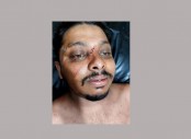 বগুড়ায় জমি সংক্রান্ত বিরোধে পুলিশের বিরুদ্ধে মারধরের অভিযোগ, যুবক হাসপাতালে