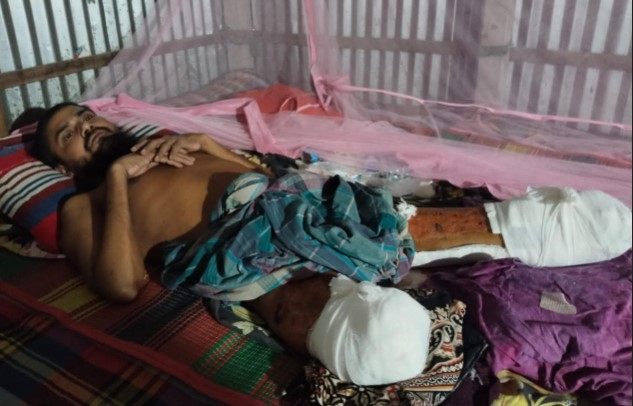 রায়গঞ্জে সড়ক দুর্ঘটনায় দু’পা হারিয়ে কর্মহীন রফিকুল;  সন্তানের পড়াশোনা  অনিশ্চিত 