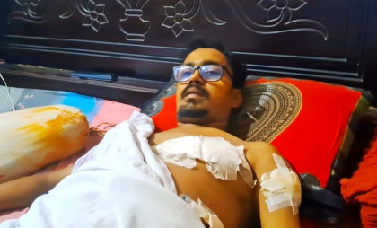 বগুড়ায় চলন্ত মোটরসাইকেলে হামলা, সুব্রতের শরীরে ১৭২ সেলাই
